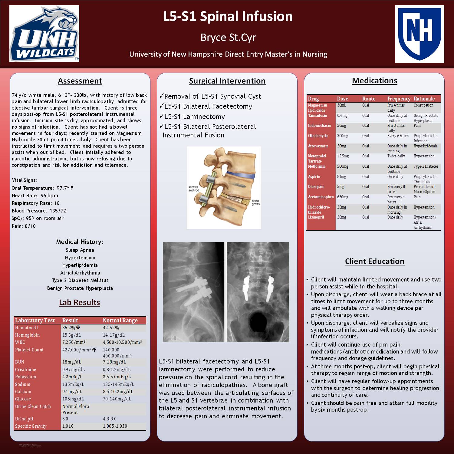 Case Study: L5-S1 Spinal Infusion by bac36