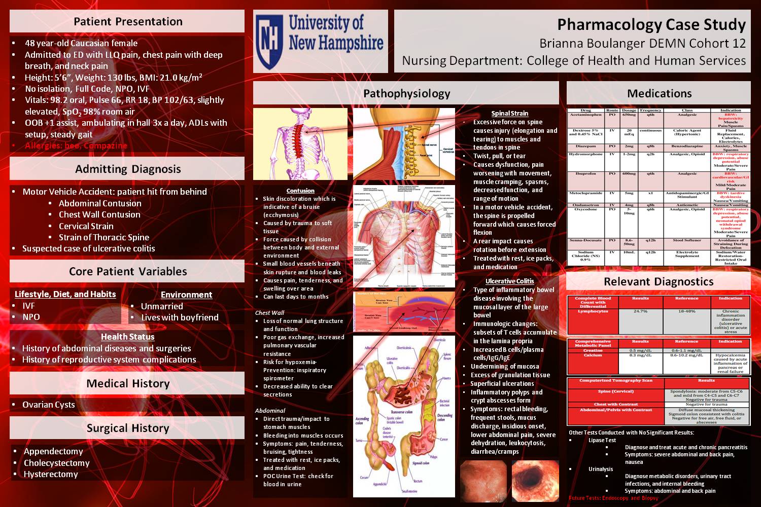 Pathophysiology And Pharmacology Case Study (Mva, Ulcerative Colitis) by bmm59